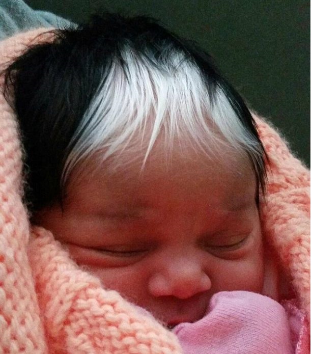 Génétique: Elle a hérité la même mèche blanche de cheveux que sa maman (photos)