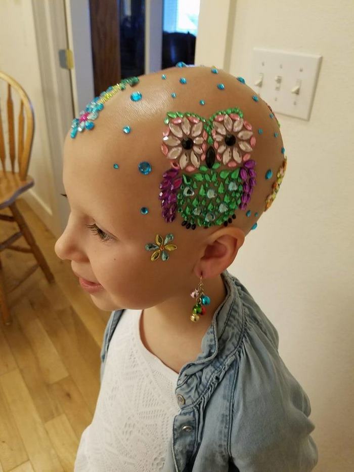 Cette fille de 7 ans n’a pas laissé l’alopécie l’arrêter d’éblouir tout le monde à l’école
