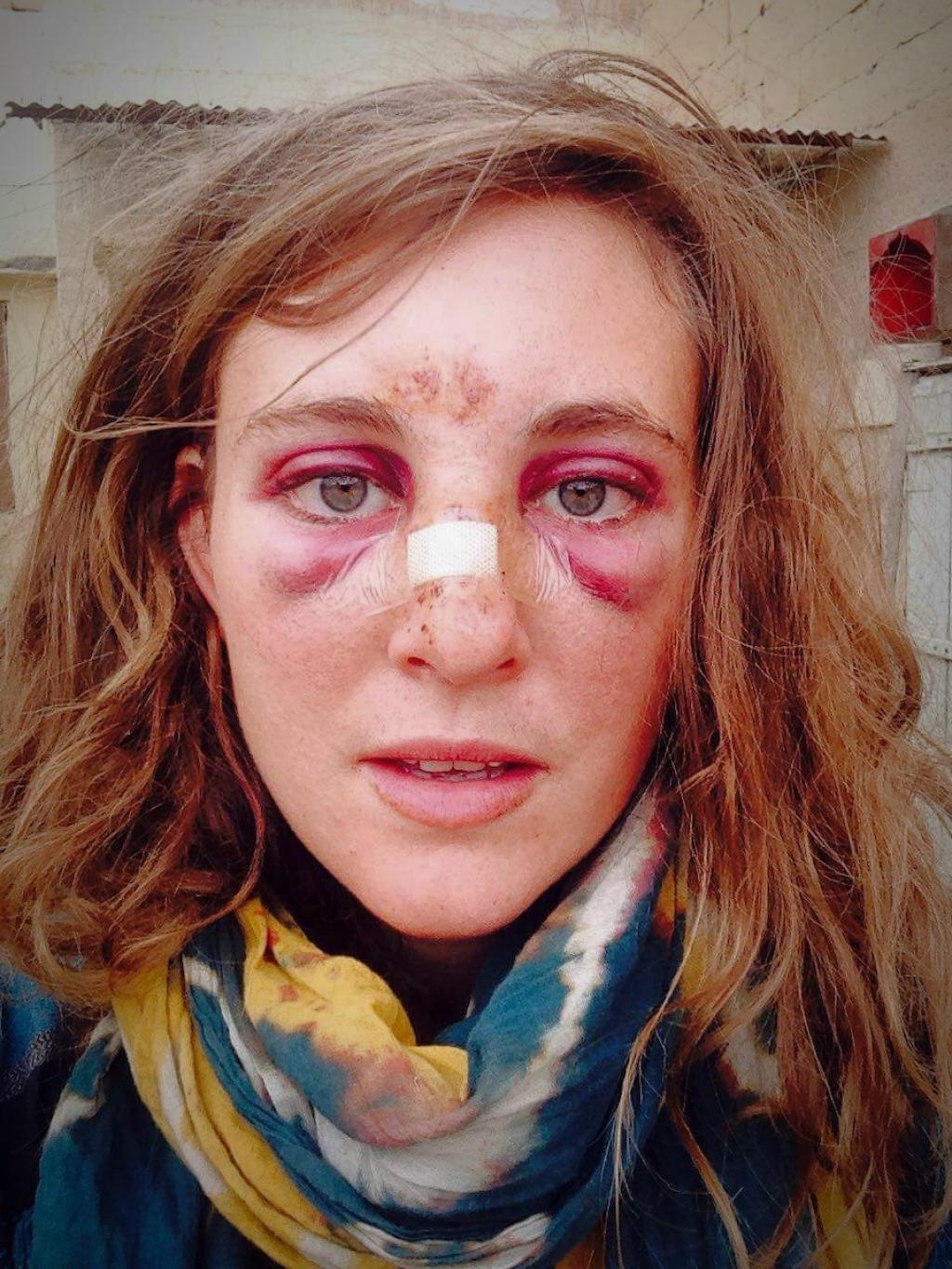 Une jeune femme en randonnée est attaquée par une vache, la cause est …